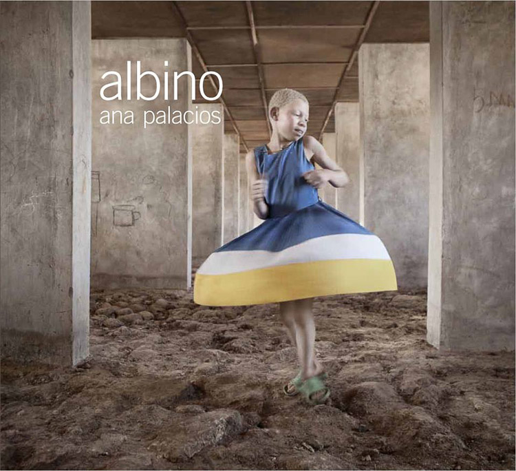 "Albino" de Ana Palacios